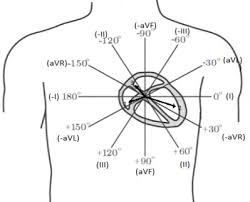 Resultado de imagen para vectocardiograma